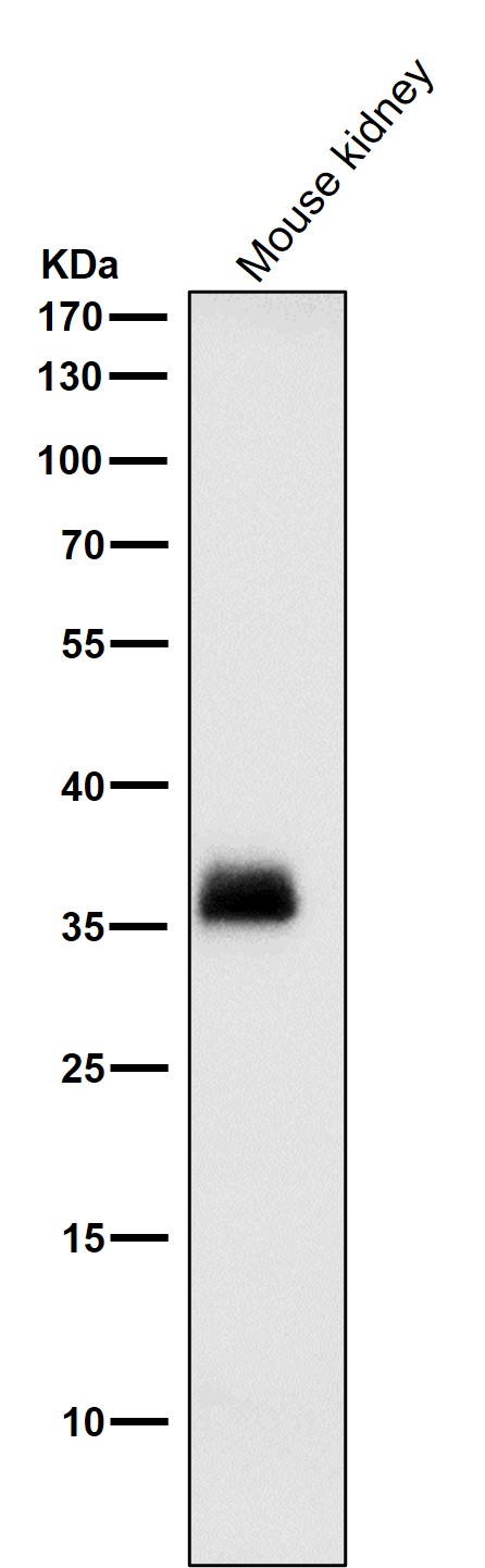 FRP 1 Ab