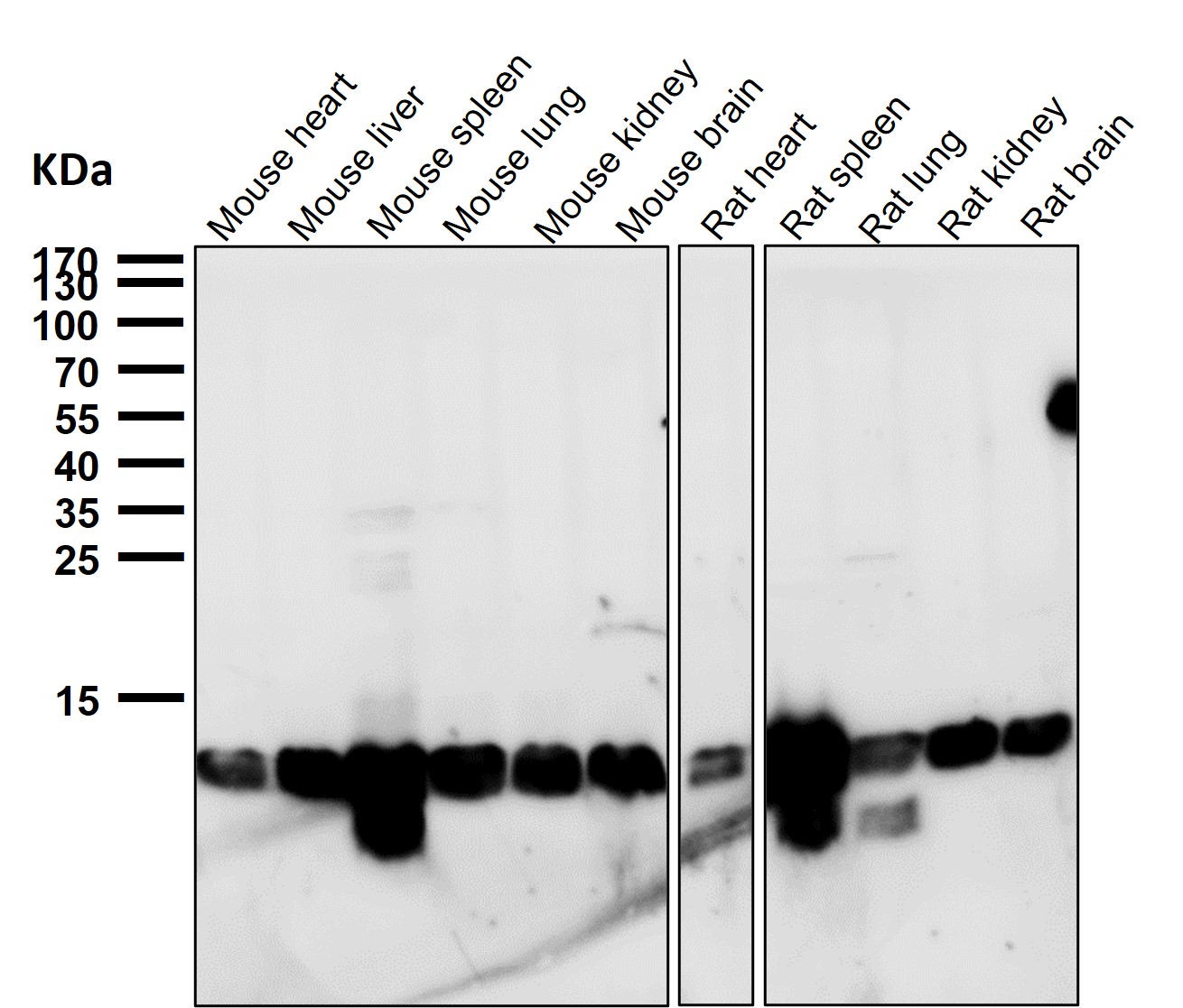 Profilin 1 Ab