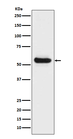 Lipoprotein lipase Ab