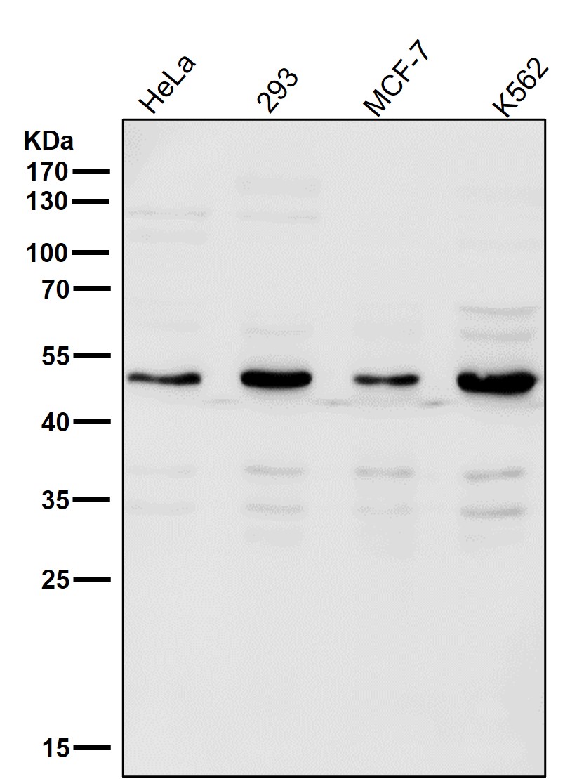 Lipoprotein lipase Ab