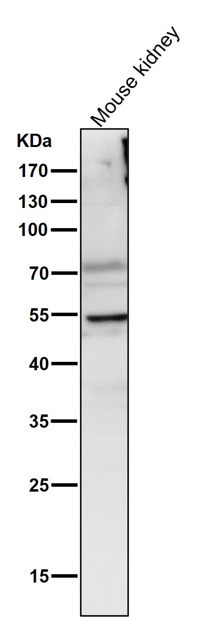 Lipoprotein lipase Ab