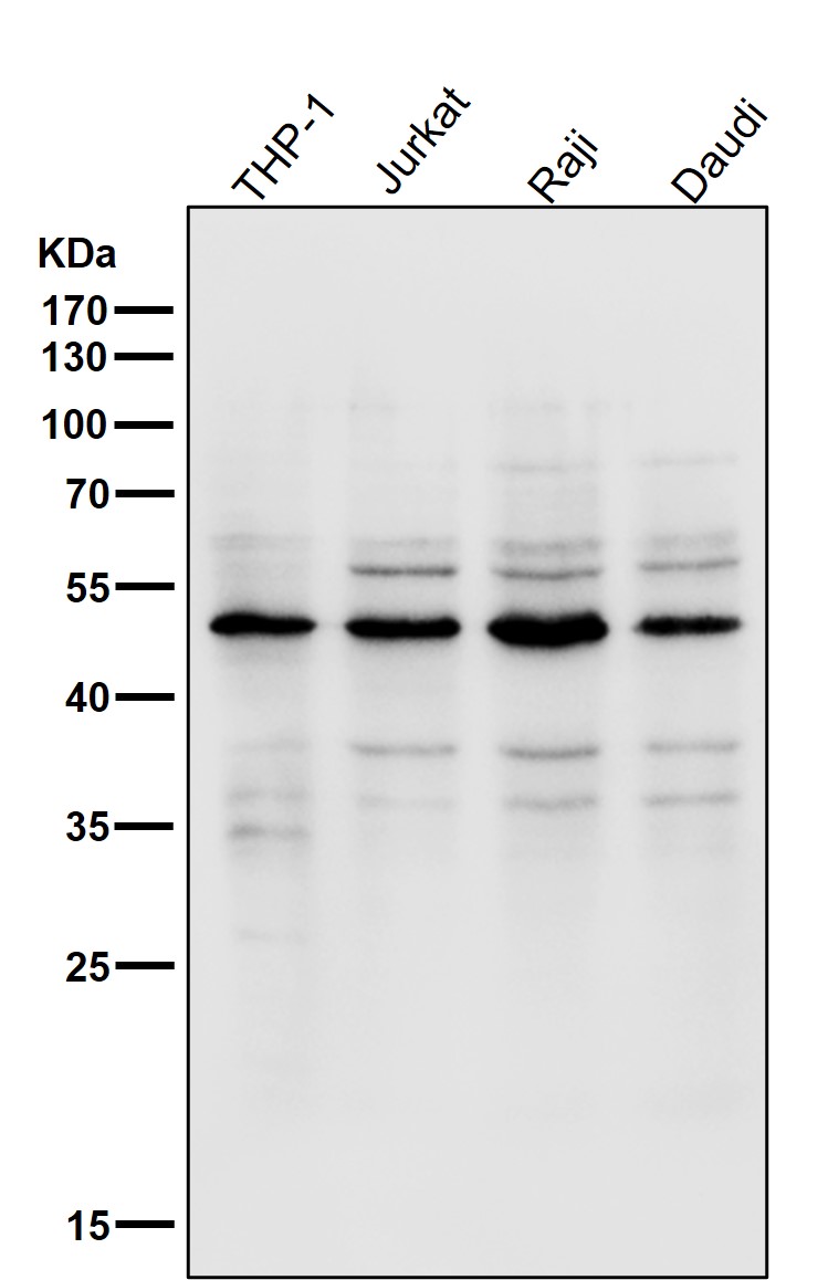 Lipoprotein lipase Ab