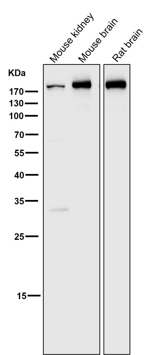 Clathrin heavy chain 1 Ab