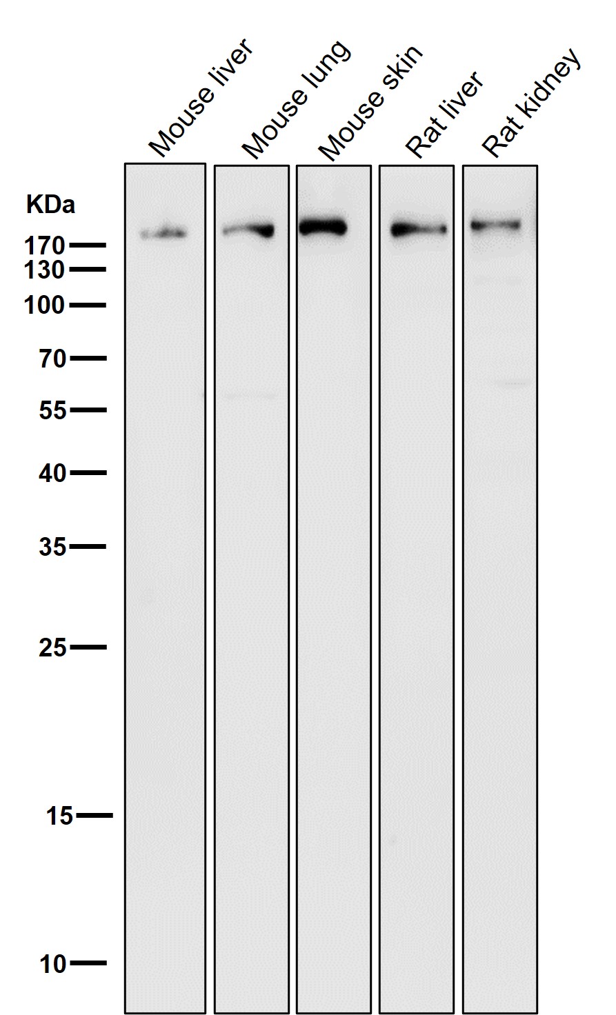 Clathrin heavy chain 1 Ab