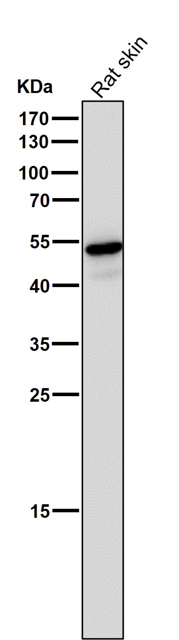 Wnt5a Ab