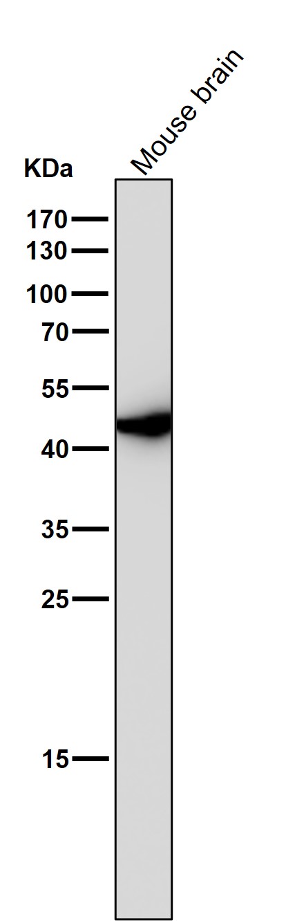 Wnt5a Ab