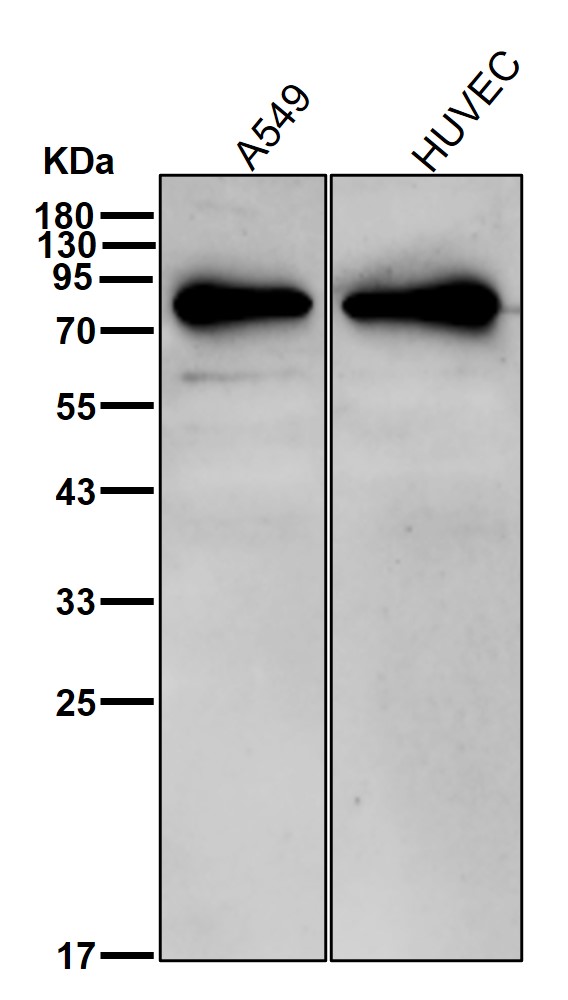 TGM2 Ab