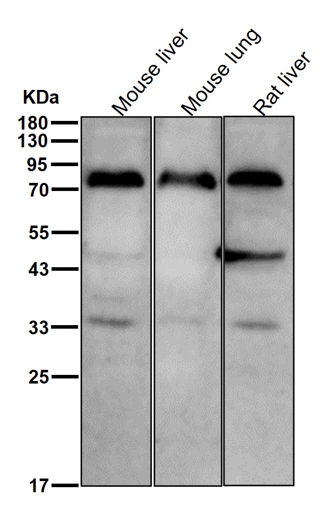 TGM2 Ab