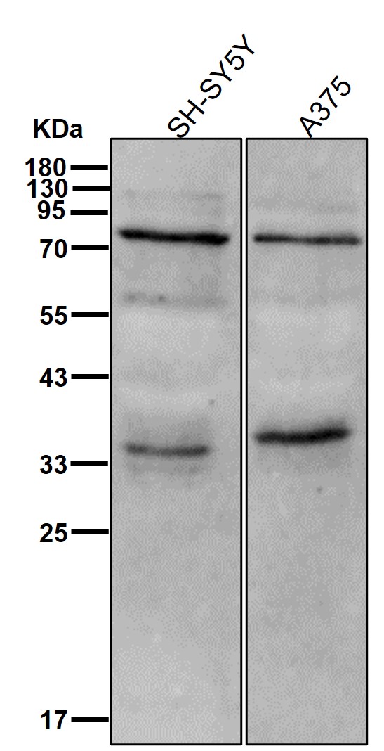 TGM2 Ab