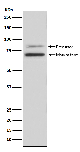 PCSK9 Ab