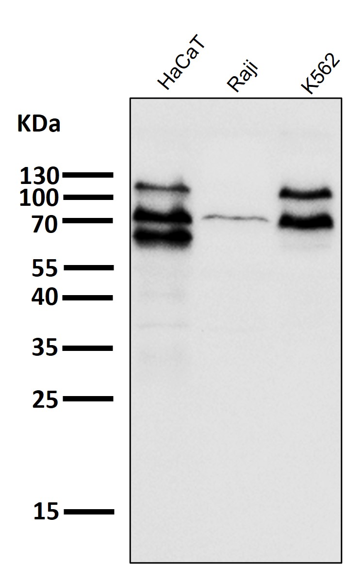 PCSK9 Ab