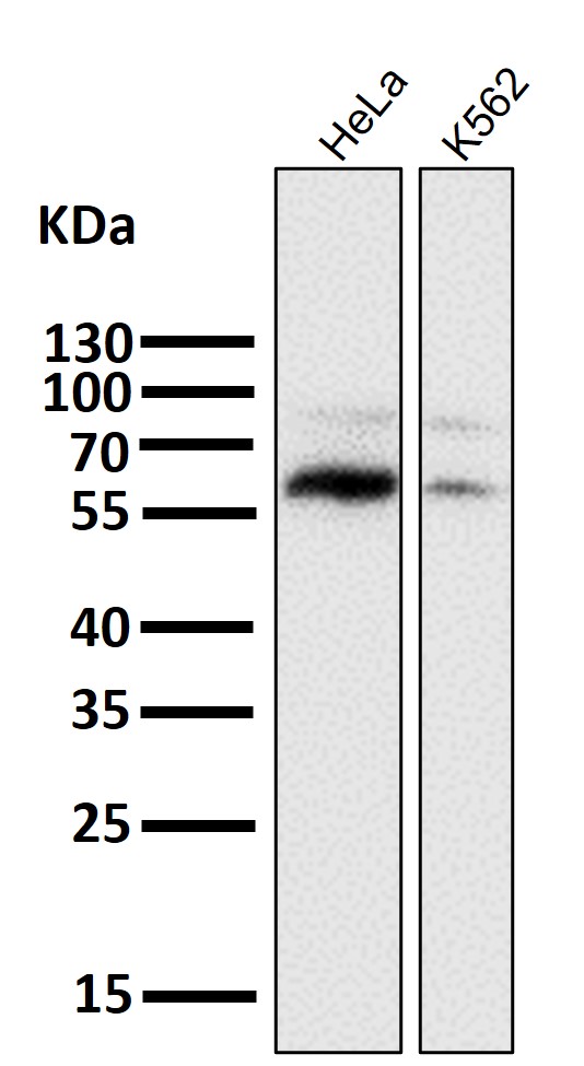 PCSK9 Ab