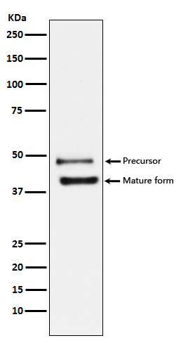 DR5 Ab