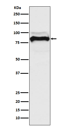 TGFR 2 Ab