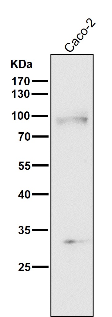 TGFR 2 Ab