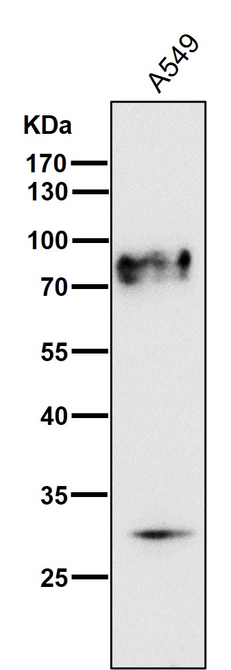 TGFR 2 Ab