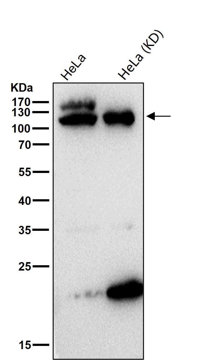 BUB1B Ab