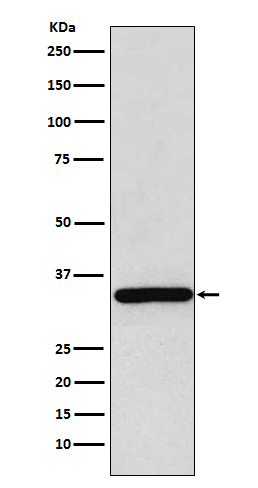 gamma Sarcoglycan Ab