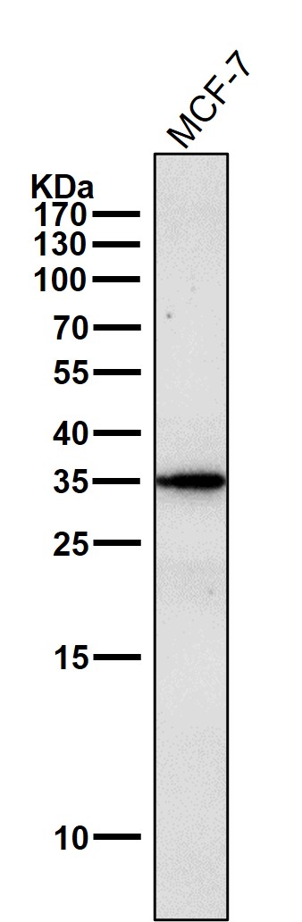 gamma Sarcoglycan Ab