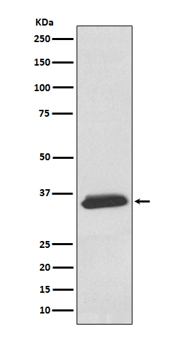 delta Sarcoglycan Ab