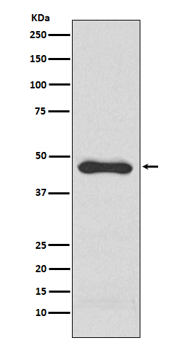 PAI 1 Ab