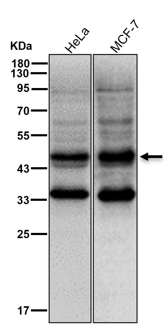 PAI 1 Ab