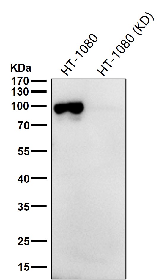 Sortilin Ab