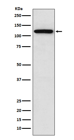 Sortilin Ab