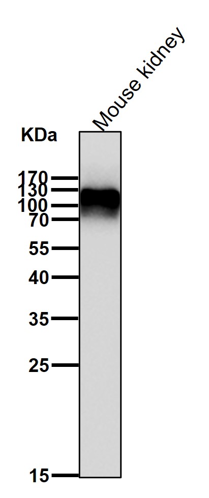 Sortilin Ab