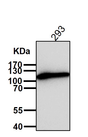 Sortilin Ab