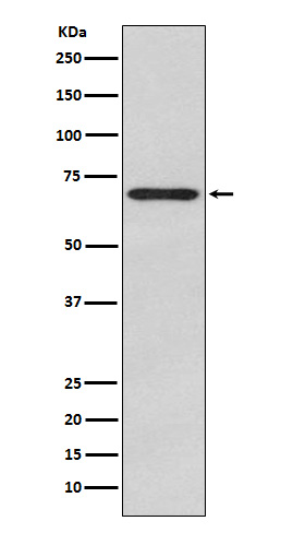 Glypican 3 Ab