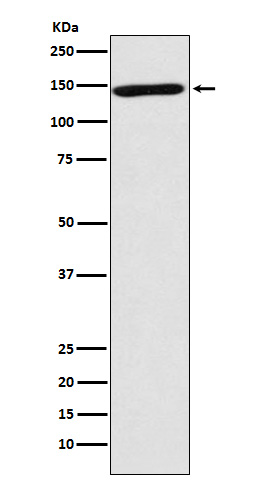 Neuronal cell adhesion molecule Ab