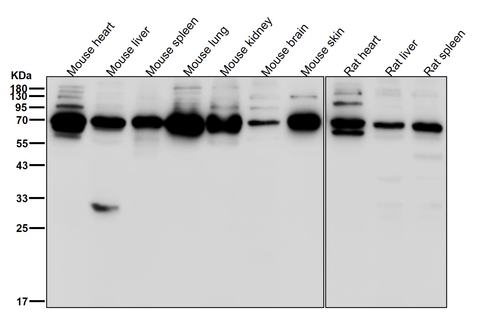 ENTPD1 Ab