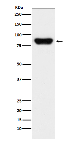 Prothrombin Ab