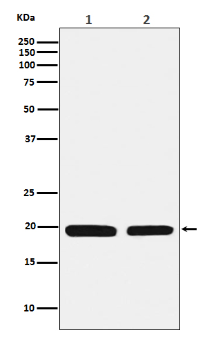 Ferritin light chain Ab