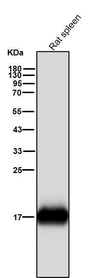 Ferritin light chain Ab