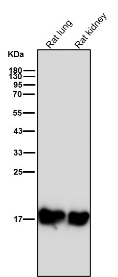 Ferritin light chain Ab