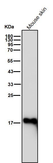 Ferritin light chain Ab