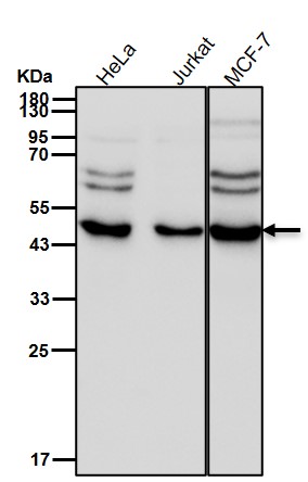 FEN1 Ab