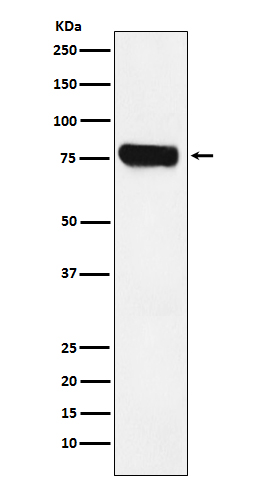 Kinetochore protein NDC80 homolog Ab