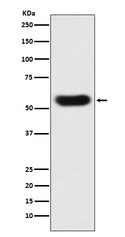 Antithrombin 3 Ab