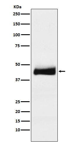 AGP 1 Ab