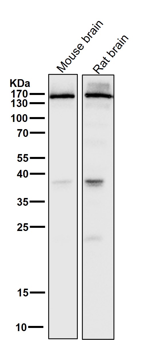 GluN2A Ab