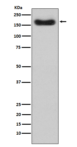 Complement factor H Ab