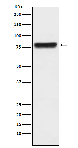 Plasma kallikrein Ab