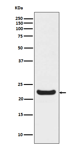 Retinol binding protein 4 Ab