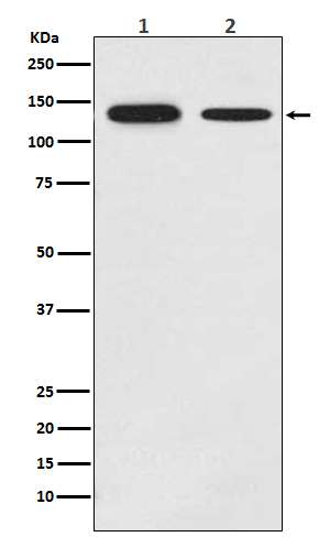 Growth hormone receptor Ab