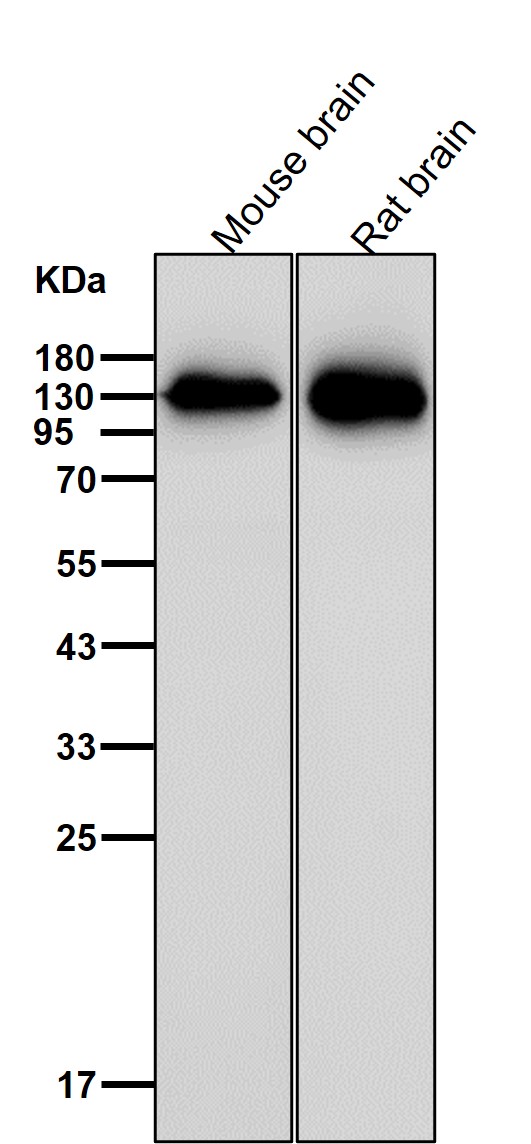 Growth hormone receptor Ab