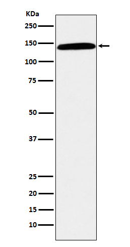 Glycoprotein Ibalpha Ab