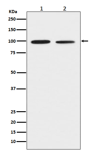 Discoidin domain receptor 2 Ab